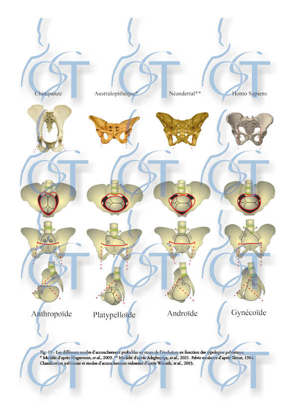 Le pelvis120